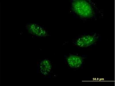 Immunocytochemistry/ Immunofluorescence: ZNF501 Antibody [H00115560-B01P]