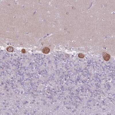 Immunohistochemistry-Paraffin: ZNF501 Antibody [NBP2-13577]