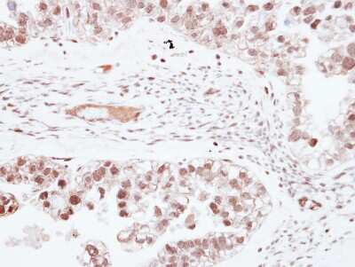 Immunohistochemistry-Paraffin: ZNF501 Antibody [NBP2-21020]