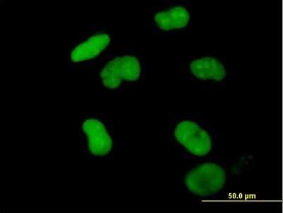 Immunocytochemistry/ Immunofluorescence: ZNF502 Antibody [H00091392-B01P]