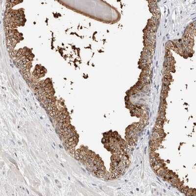 Immunohistochemistry-Paraffin: ZNF502 Antibody [NBP1-82297]