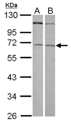 Western Blot: ZNF503 Antibody [NBP2-21021]