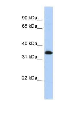 Western Blot: ZNF511 Antibody [NBP1-80279]