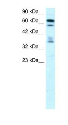 Western Blot: ZNF512 Antibody [NBP1-79967]