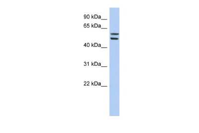 Western Blot: ZNF513 Antibody [NBP2-86509]