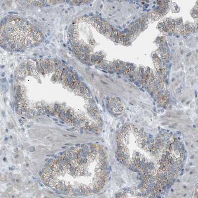 Immunohistochemistry-Paraffin: ZNF516 Antibody [NBP1-93685]