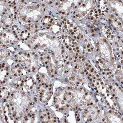 Immunohistochemistry-Paraffin: ZNF518B Antibody [NBP1-81380]