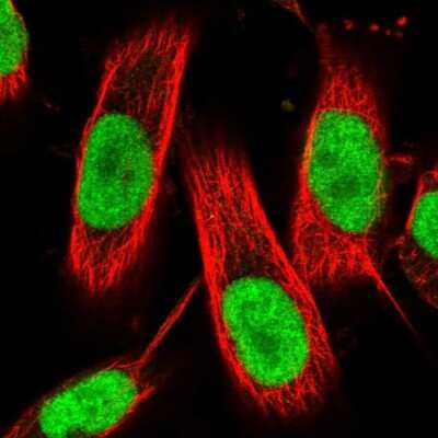 Immunocytochemistry/ Immunofluorescence: ZNF521 Antibody [NBP1-84883]