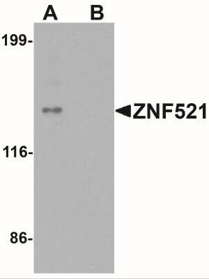 Western Blot: ZNF521 AntibodyBSA Free [NBP2-41174]