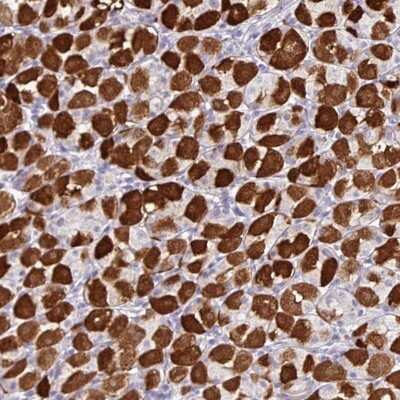 Immunohistochemistry-Paraffin: ZNF524 Antibody [NBP2-13579]