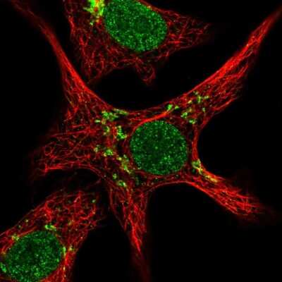 Immunocytochemistry/ Immunofluorescence: ZNF526 Antibody [NBP2-32007]
