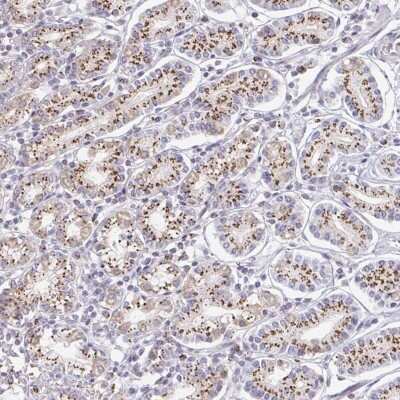 Immunohistochemistry: ZNF526 Antibody [NBP2-32007]
