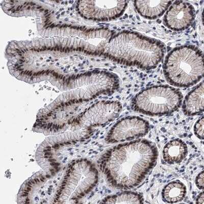 Immunohistochemistry-Paraffin: ZNF529 Antibody [NBP1-81396]