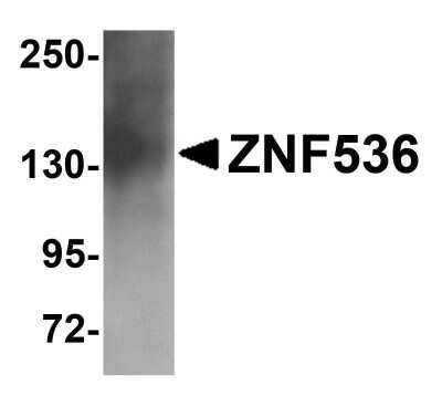 Western Blot: ZNF536 AntibodyBSA Free [NBP1-77092]