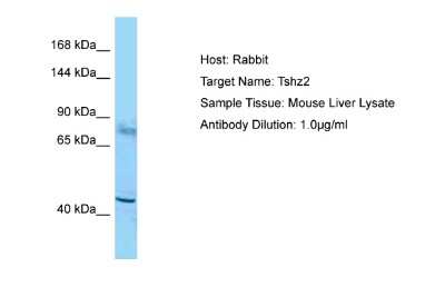 Western Blot: ZNF537 Antibody [NBP2-83864]