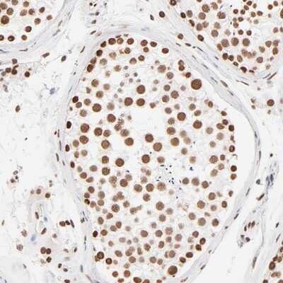 Immunohistochemistry-Paraffin: ZNF540 Antibody [NBP1-84170]