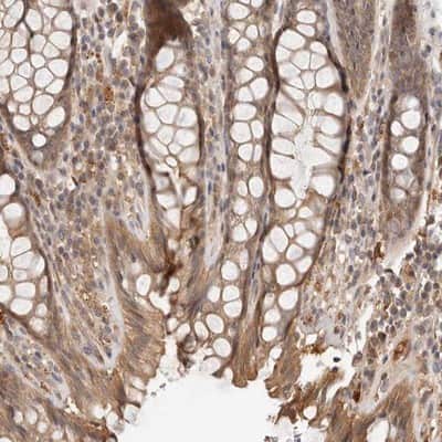 Immunohistochemistry-Paraffin: ZNF543 Antibody [NBP1-85122]