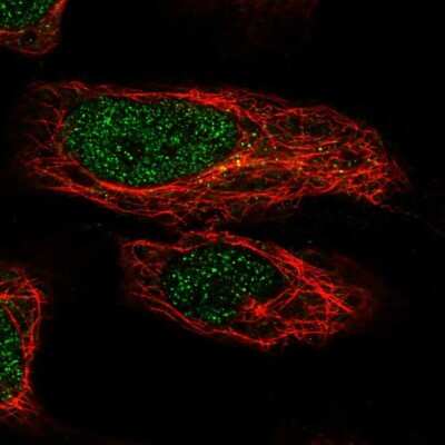 Immunocytochemistry/ Immunofluorescence: ZNF548 Antibody [NBP2-39065]