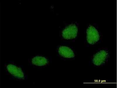 Immunocytochemistry/ Immunofluorescence: ZNF549 Antibody [H00256051-B01P]