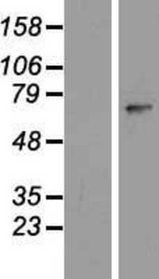 Western Blot: ZNF549 Overexpression Lysate [NBP2-05270]