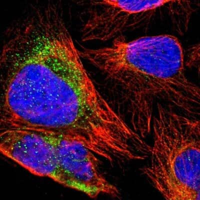 Immunocytochemistry/ Immunofluorescence: ZNF550 Antibody [NBP1-86158]