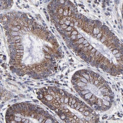 Immunohistochemistry-Paraffin: ZNF550 Antibody [NBP1-86158]