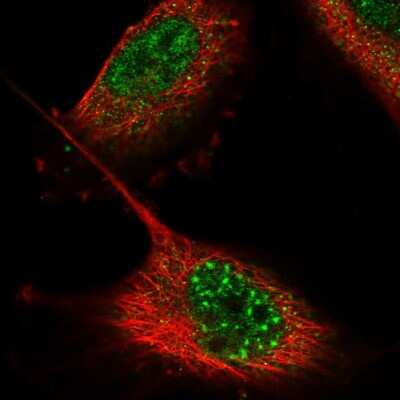 Immunocytochemistry/ Immunofluorescence: ZNF551 Antibody [NBP2-55282]