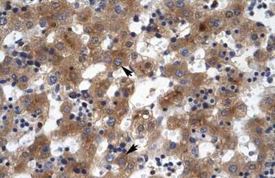 Immunohistochemistry-Paraffin: ZNF551 Antibody [NBP1-80139]