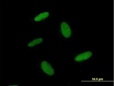 Immunocytochemistry/ Immunofluorescence: ZNF557 Antibody [H00079230-B01P]