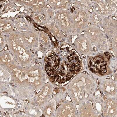 Immunohistochemistry-Paraffin: ZNF557 Antibody [NBP1-81084]