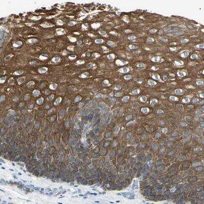 Immunohistochemistry-Paraffin: ZNF558 Antibody [NBP1-82032]