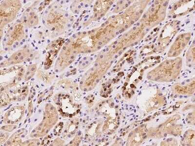 Immunohistochemistry-Paraffin: ZNF558 Antibody [NBP2-97849]