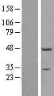 Western Blot: ZNF558 Overexpression Lysate [NBL1-18184]