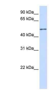 Western Blot: ZNF561 Antibody [NBP1-80148]