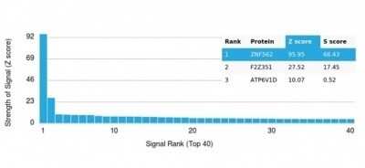 Protein Array: ZNF562 Antibody (PCRP-ZNF562-1A1) [NBP3-13747]