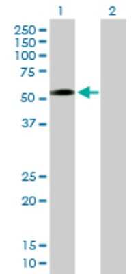 Western Blot: ZNF563 Antibody [H00147837-B01P]