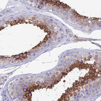Immunohistochemistry-Paraffin: ZNF564 Antibody [NBP1-92630]