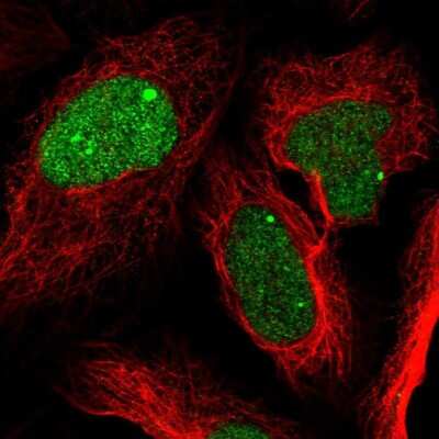 Immunocytochemistry/ Immunofluorescence: ZNF565 Antibody [NBP1-81951]