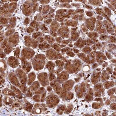 Immunohistochemistry-Paraffin: ZNF565 Antibody [NBP1-81951]