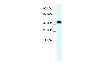 Western Blot: ZNF568 Antibody [NBP2-83871]