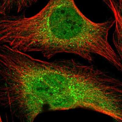 Immunocytochemistry/ Immunofluorescence: ZNF569 Antibody [NBP2-30747]