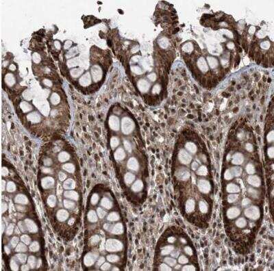 Immunohistochemistry-Paraffin: ZNF570 Antibody [NBP1-82035]