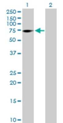 Western Blot: ZNF571 Antibody [H00051276-B01P]