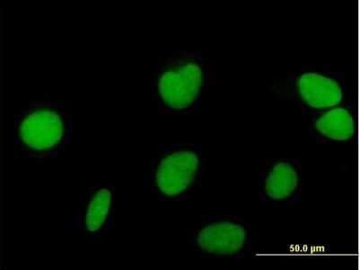 Immunocytochemistry/ Immunofluorescence: ZNF573 Antibody [H00126231-B01P]