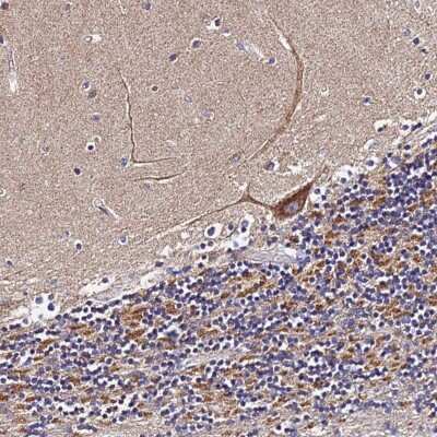 Immunohistochemistry-Paraffin: ZNF573 Antibody [NBP1-92631]