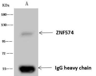 Immunoprecipitation: ZNF574 Antibody [NBP3-12605]
