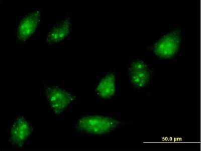 Immunocytochemistry/ Immunofluorescence: ZNF576 Antibody [H00079177-B01P]