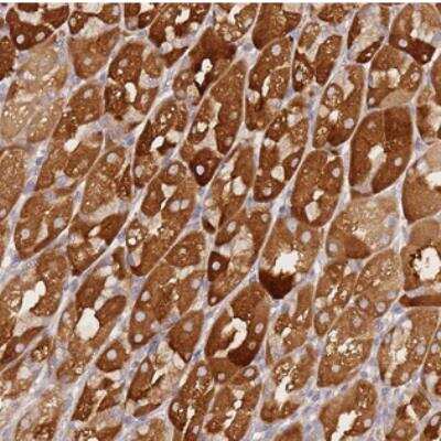 Immunohistochemistry-Paraffin: ZNF577 Antibody [NBP2-31026]