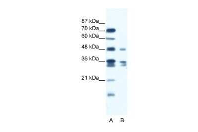 Western Blot: ZNF577 Antibody [NBP2-86522]