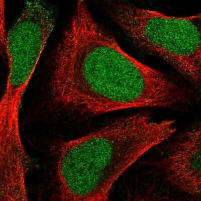 Immunocytochemistry/ Immunofluorescence: ZNF580 Antibody [NBP2-47565]